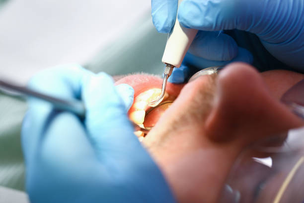 Best Tooth Pain Emergency Relief  in Le Roy, IL